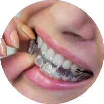 Sorriso com alinhador transparente
